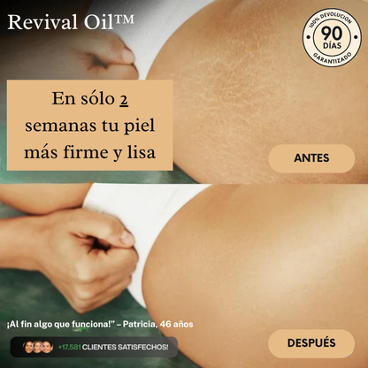 Revival Oil™ | Piel Más Firme en 2 Semanas